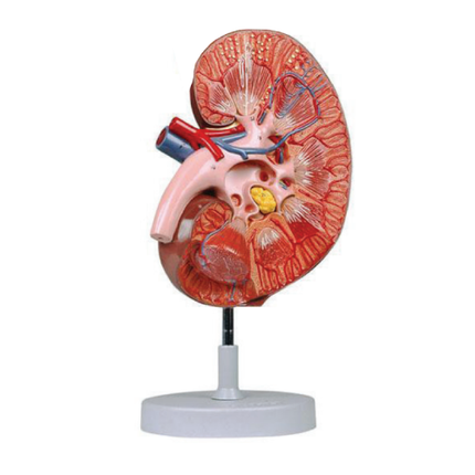 Expansion Model of Kidney