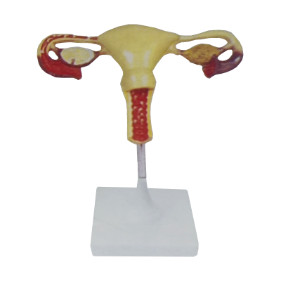 Anatomy Model of Natural Uterus