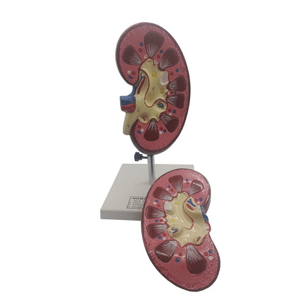 Human Kidney Model | 15.5cm x 15.5cm x 27cm