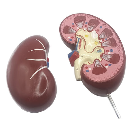 Human Kidney Model | 15.5cm x 15.5cm x 27cm