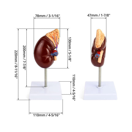 Life-Size Human Kidney Model on Stand | Divided into 2 Parts