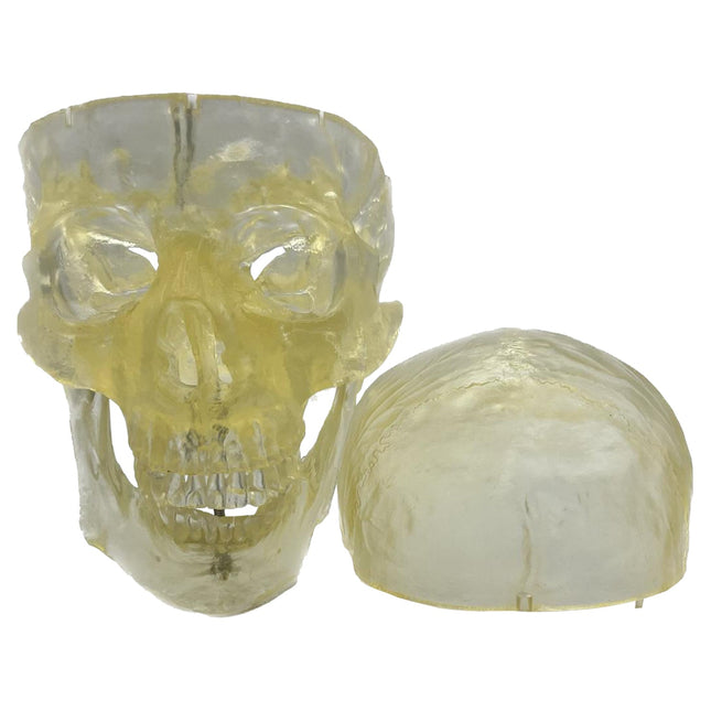 Transparent Human Skull Model with Removable Skull Cap