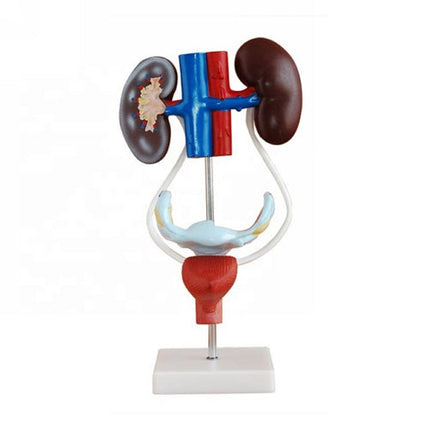 Anatomy Model of Female Urinary System