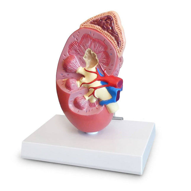 Kidney Anatomy Model with Base and Description Board | 2-Times Life-Size