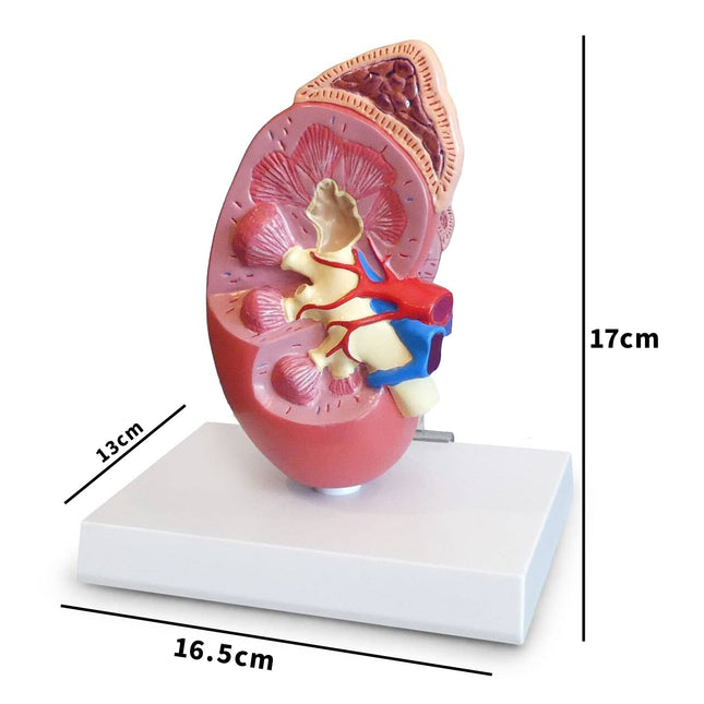 Kidney Anatomy Model with Base and Description Board | 2-Times Life-Size