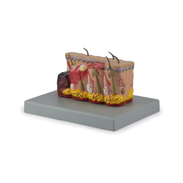 Pathological Model of Burnt Skin 30x