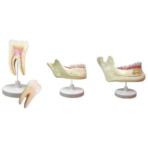 Model of Deciduous Teeth & Parmanent Teeth